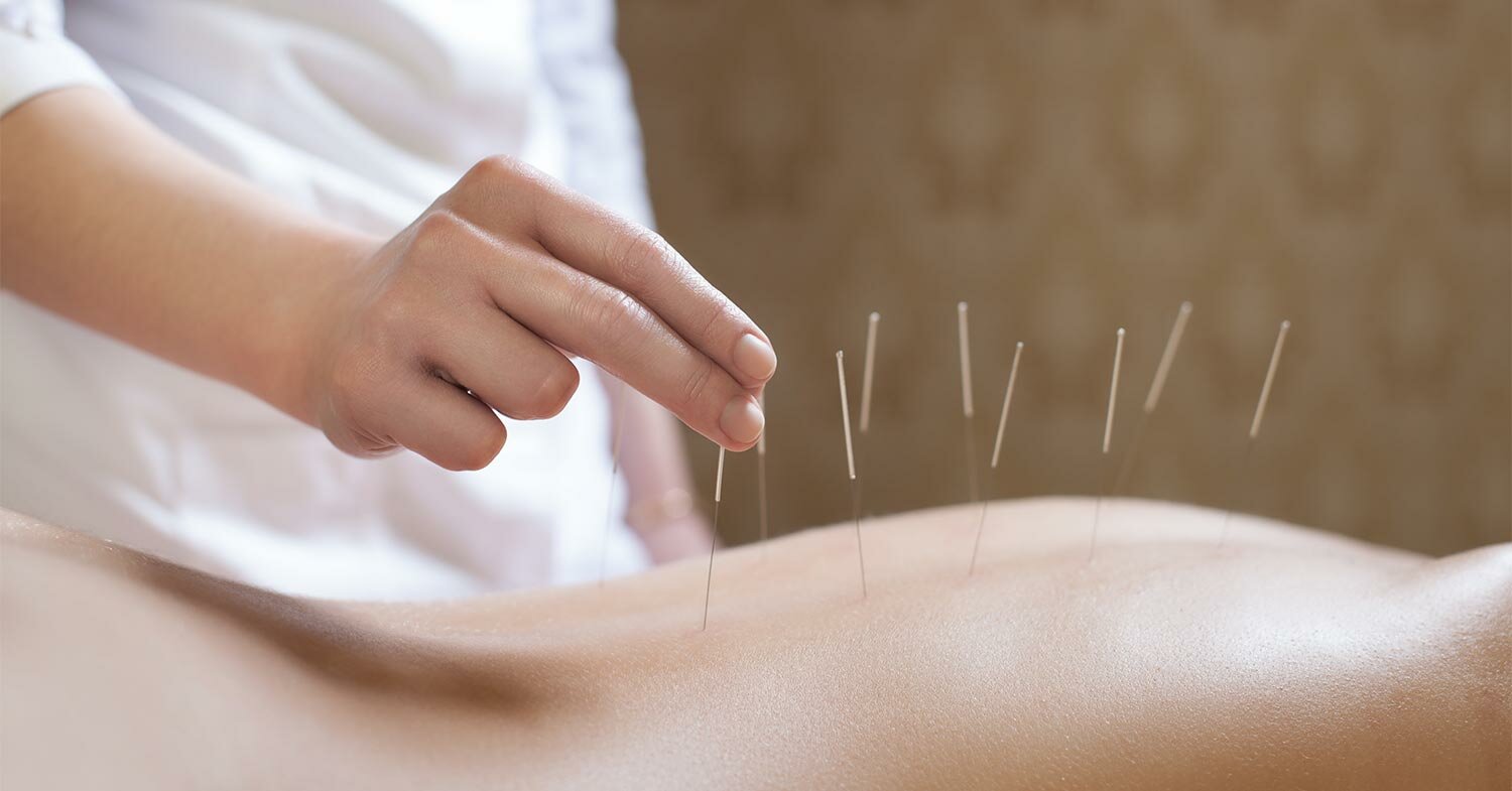 avalon laser health services tcm acupuncture